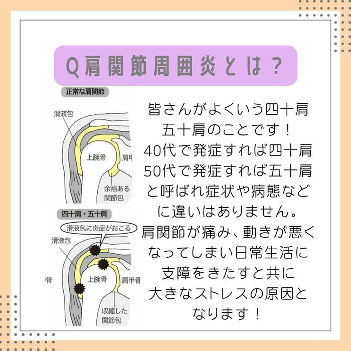 画像2322
